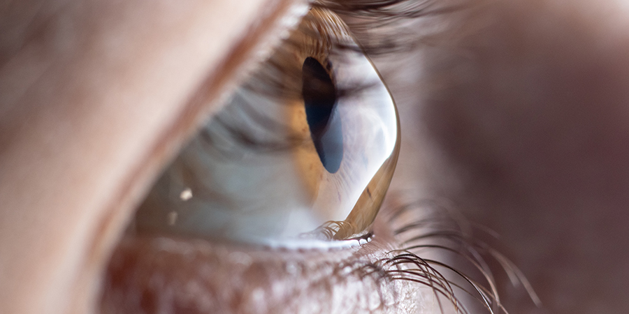 Retinal Eye Screening